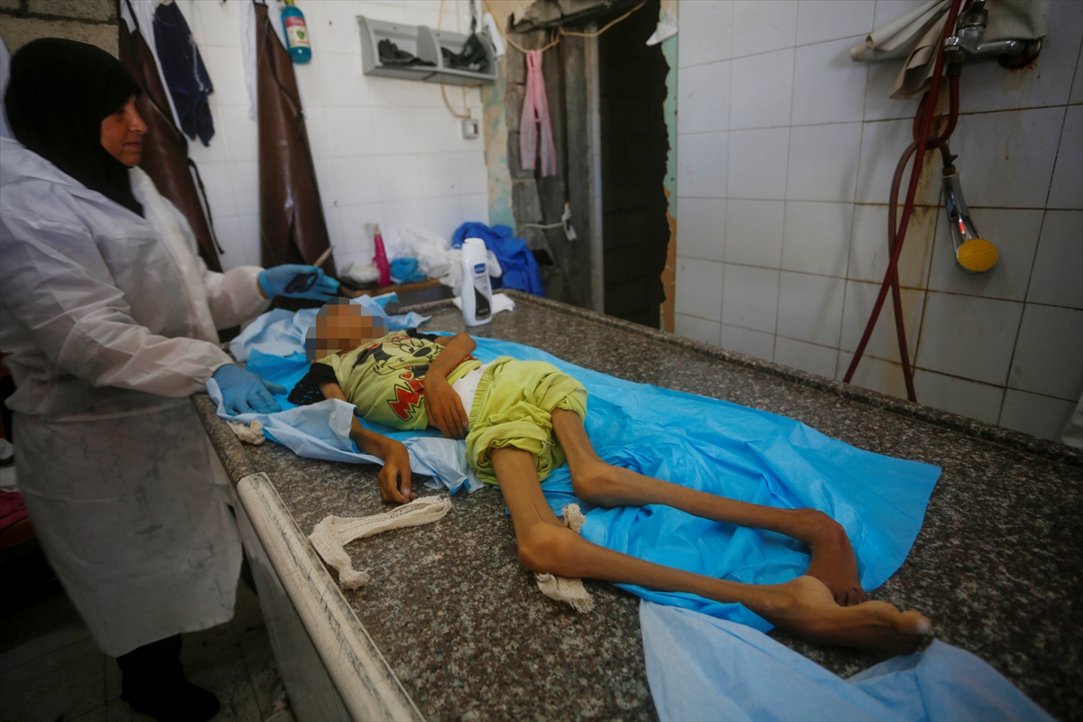 A A 20250912 39093338 39093335 G A Z Z E D E Y E T E R S I Z B E S L E N M E N E D E N I Y L E 10 Y A S I N D A K I A M I N E H A Y A T I N I K A Y B E T T I