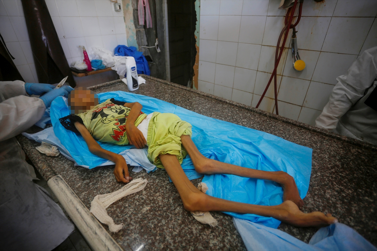 A A 20250912 39093338 39093336 G A Z Z E D E Y E T E R S I Z B E S L E N M E N E D E N I Y L E 10 Y A S I N D A K I A M I N E H A Y A T I N I K A Y B E T T I