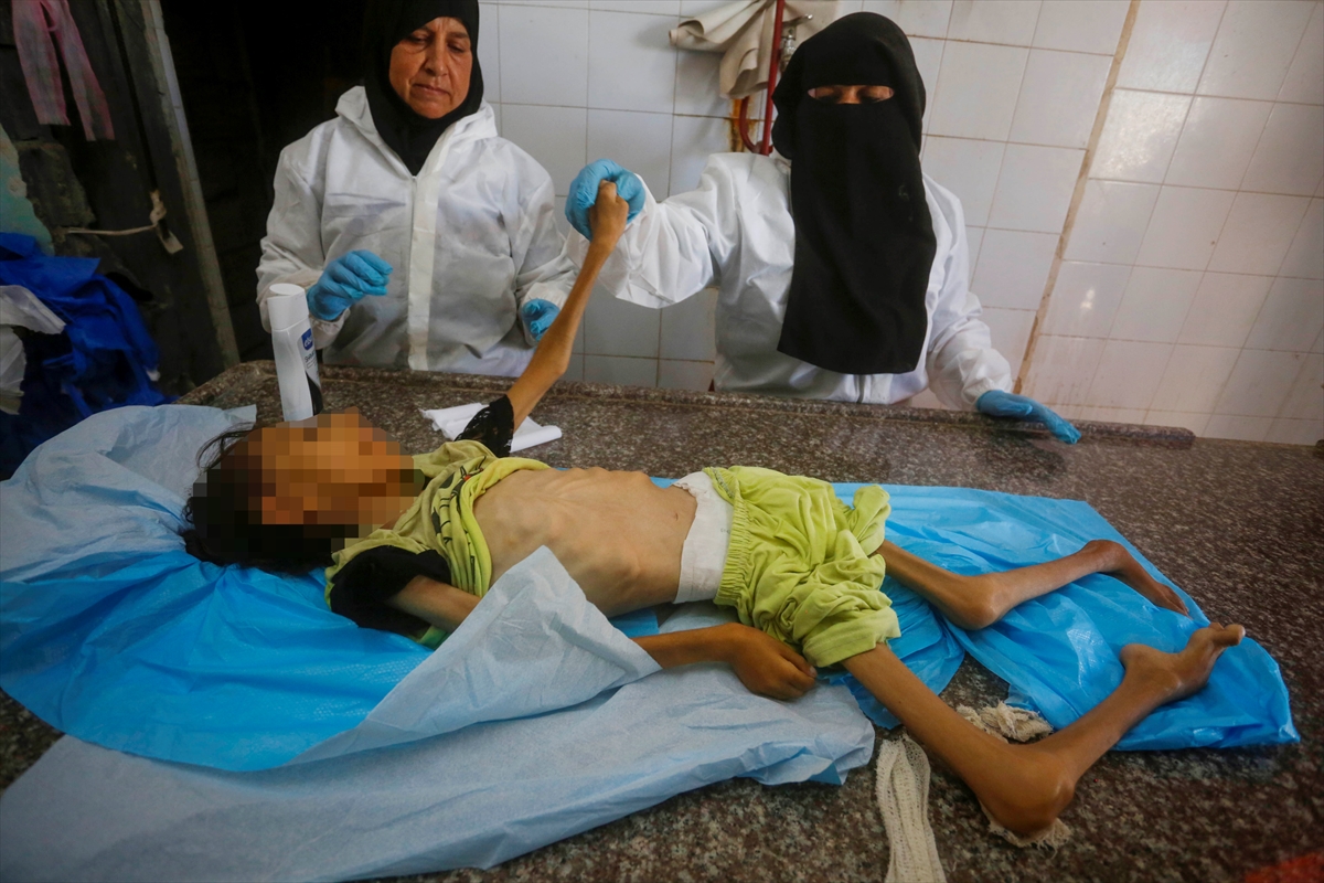 A A 20250912 39093338 39093337 G A Z Z E D E Y E T E R S I Z B E S L E N M E N E D E N I Y L E 10 Y A S I N D A K I A M I N E H A Y A T I N I K A Y B E T T I