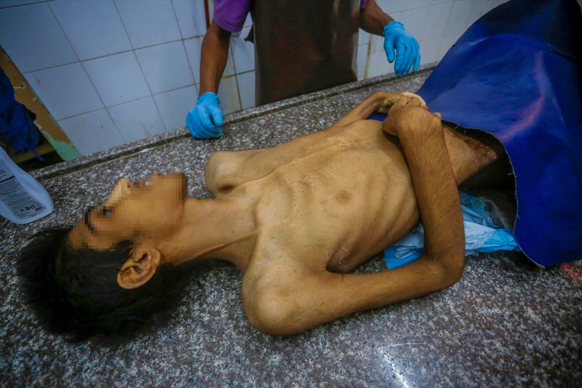 A A 20250914 39109603 39109599 G A Z Z E D E A C L I K T A N H A Y A T I N I K A Y B E D E N L E R I N S A Y I S I 421 E Y U K S E L D I