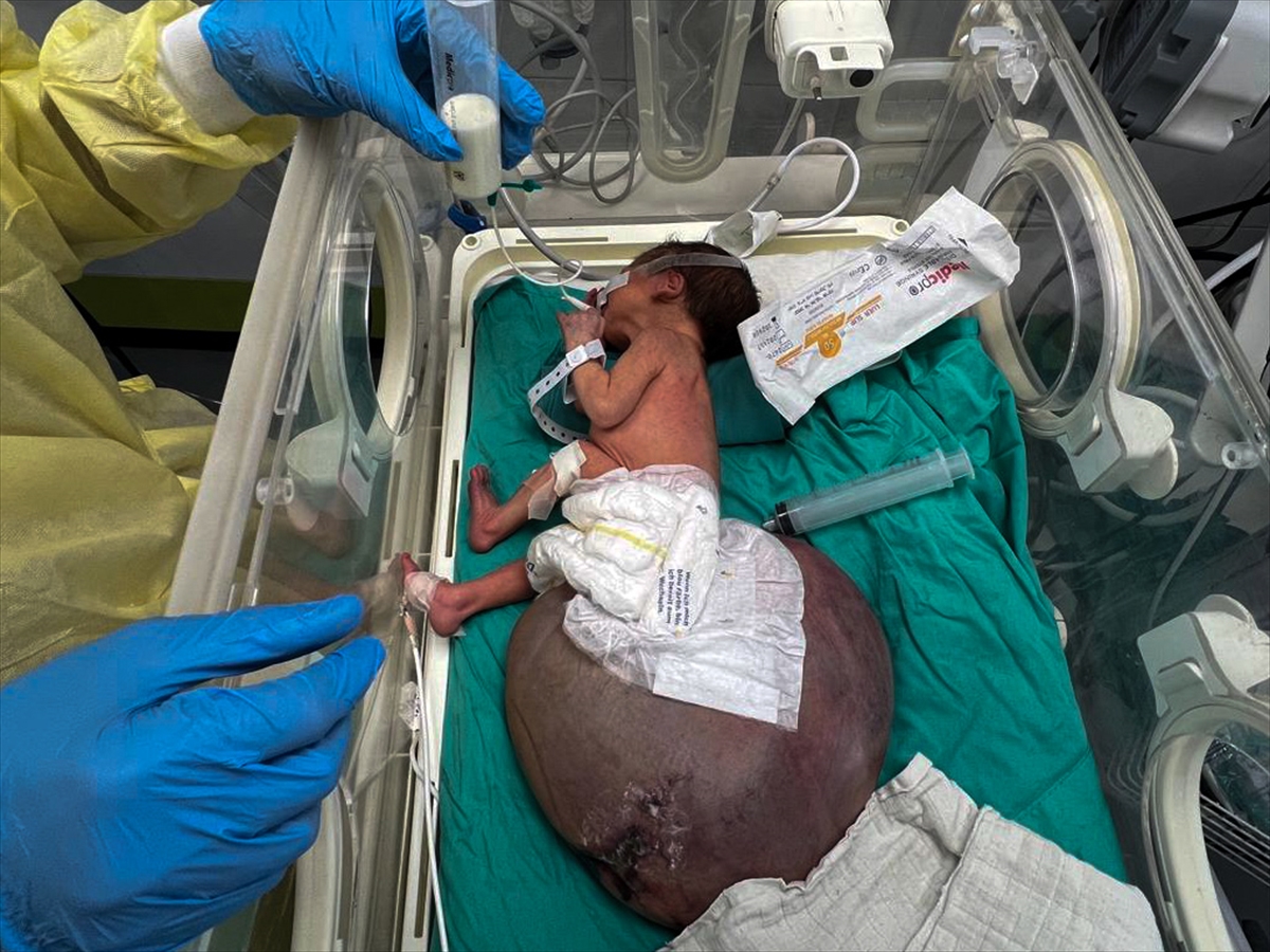 A A 20250927 39243744 39243734 G A Z Z E B E B E K T U L I N S A R S U R T I B B I M A L Z E M E E K S I K L I G I V E I S R A I L A B L U K A S I N I N P E N C E S I N D E