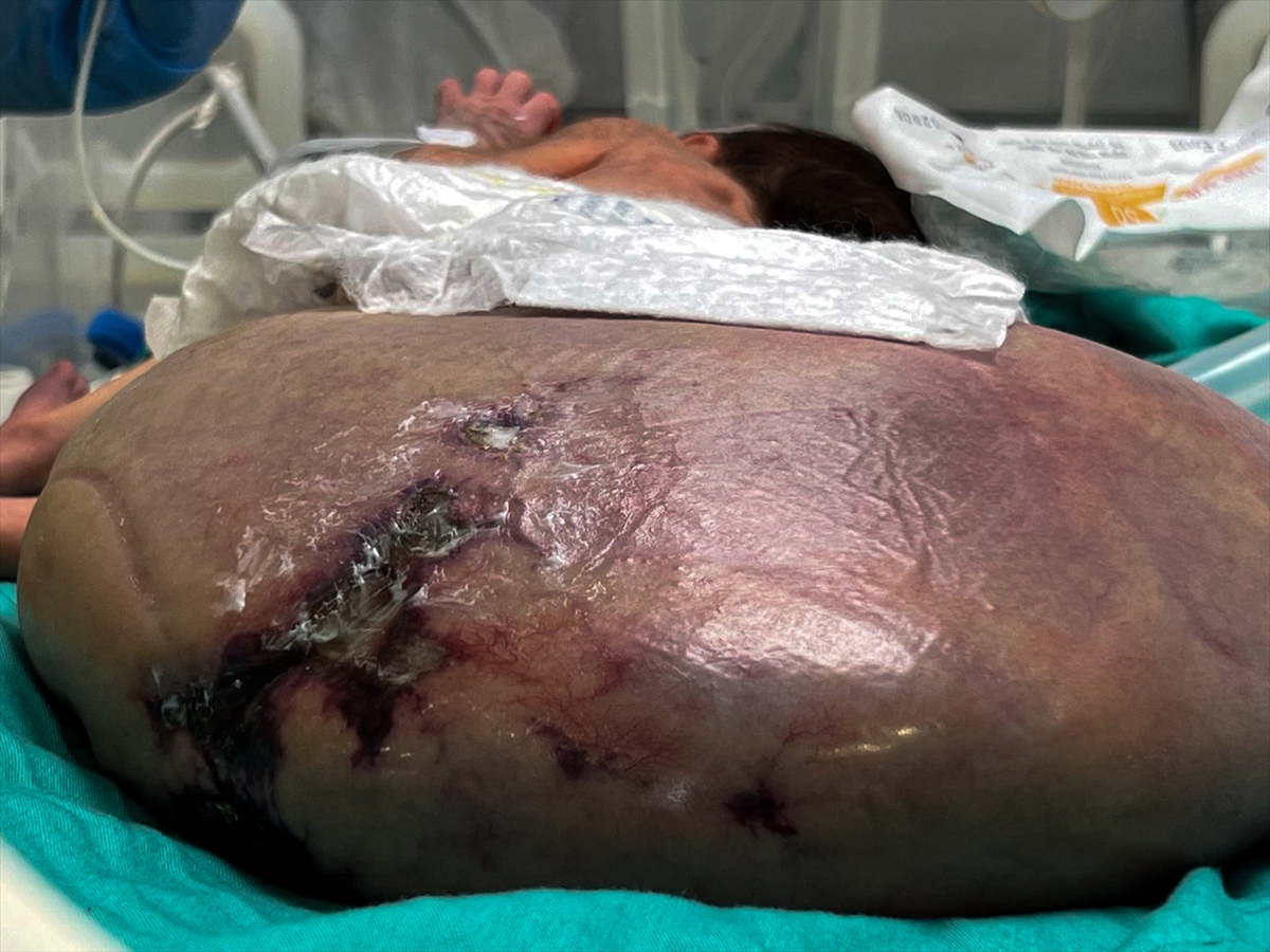 A A 20250927 39243744 39243735 G A Z Z E B E B E K T U L I N S A R S U R T I B B I M A L Z E M E E K S I K L I G I V E I S R A I L A B L U K A S I N I N P E N C E S I N D E