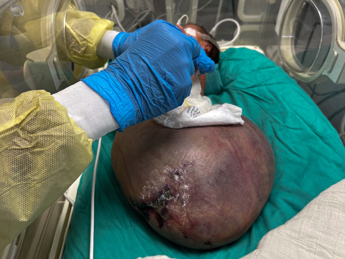 A A 20250927 39243744 39243736 G A Z Z E B E B E K T U L I N S A R S U R T I B B I M A L Z E M E E K S I K L I G I V E I S R A I L A B L U K A S I N I N P E N C E S I N D E