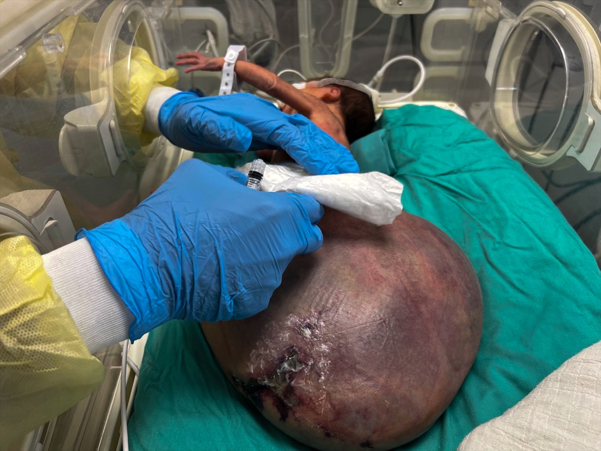 A A 20250927 39243744 39243737 G A Z Z E B E B E K T U L I N S A R S U R T I B B I M A L Z E M E E K S I K L I G I V E I S R A I L A B L U K A S I N I N P E N C E S I N D E