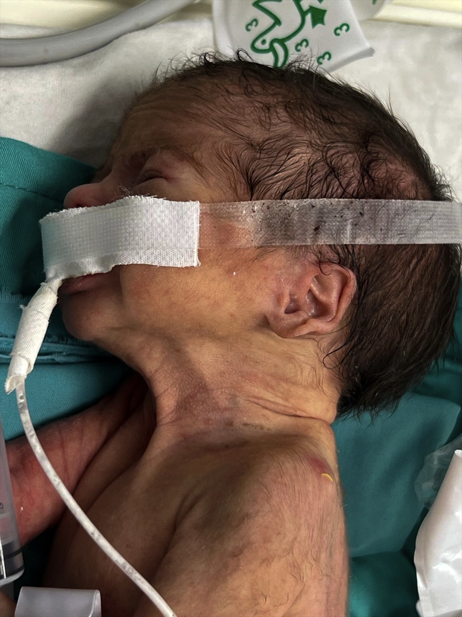 A A 20250927 39243744 39243738 G A Z Z E B E B E K T U L I N S A R S U R T I B B I M A L Z E M E E K S I K L I G I V E I S R A I L A B L U K A S I N I N P E N C E S I N D E