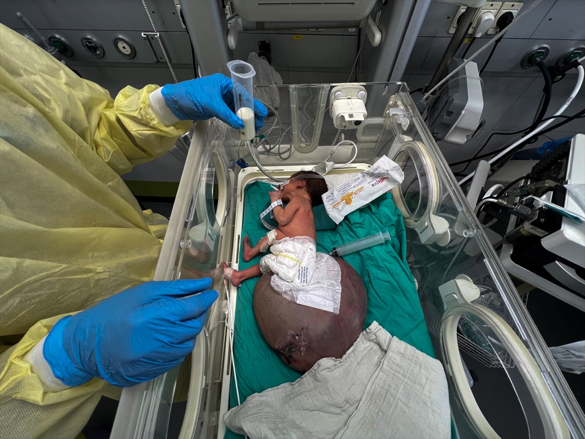 A A 20250927 39243744 39243740 G A Z Z E B E B E K T U L I N S A R S U R T I B B I M A L Z E M E E K S I K L I G I V E I S R A I L A B L U K A S I N I N P E N C E S I N D E