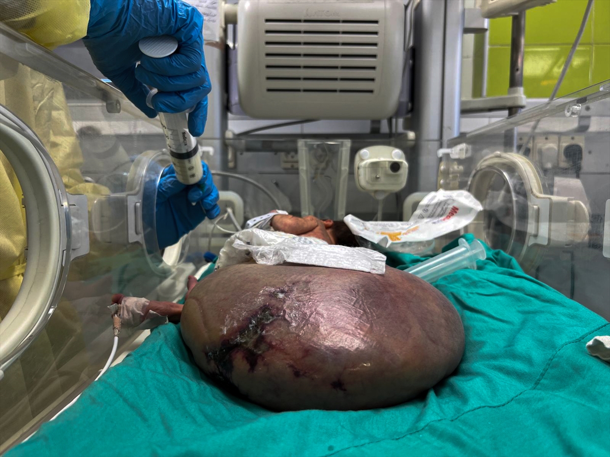 A A 20250927 39243744 39243741 G A Z Z E B E B E K T U L I N S A R S U R T I B B I M A L Z E M E E K S I K L I G I V E I S R A I L A B L U K A S I N I N P E N C E S I N D E