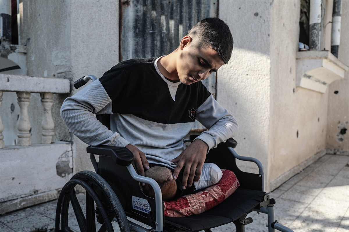 İki bacağını birden şehit veren Gazzeli çocuğun tek hayali, okumak....