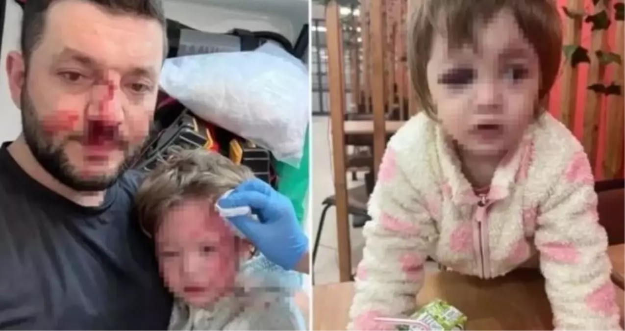 Yalova'daki saldırıya ilişkin son dakika: Bakanlık harekete geçti!