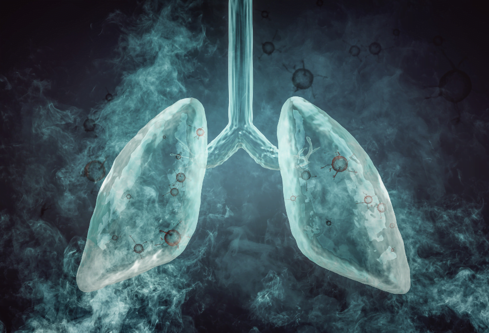 Eski Evlerin Tumunde Bulunuyor Asbest Nedir4