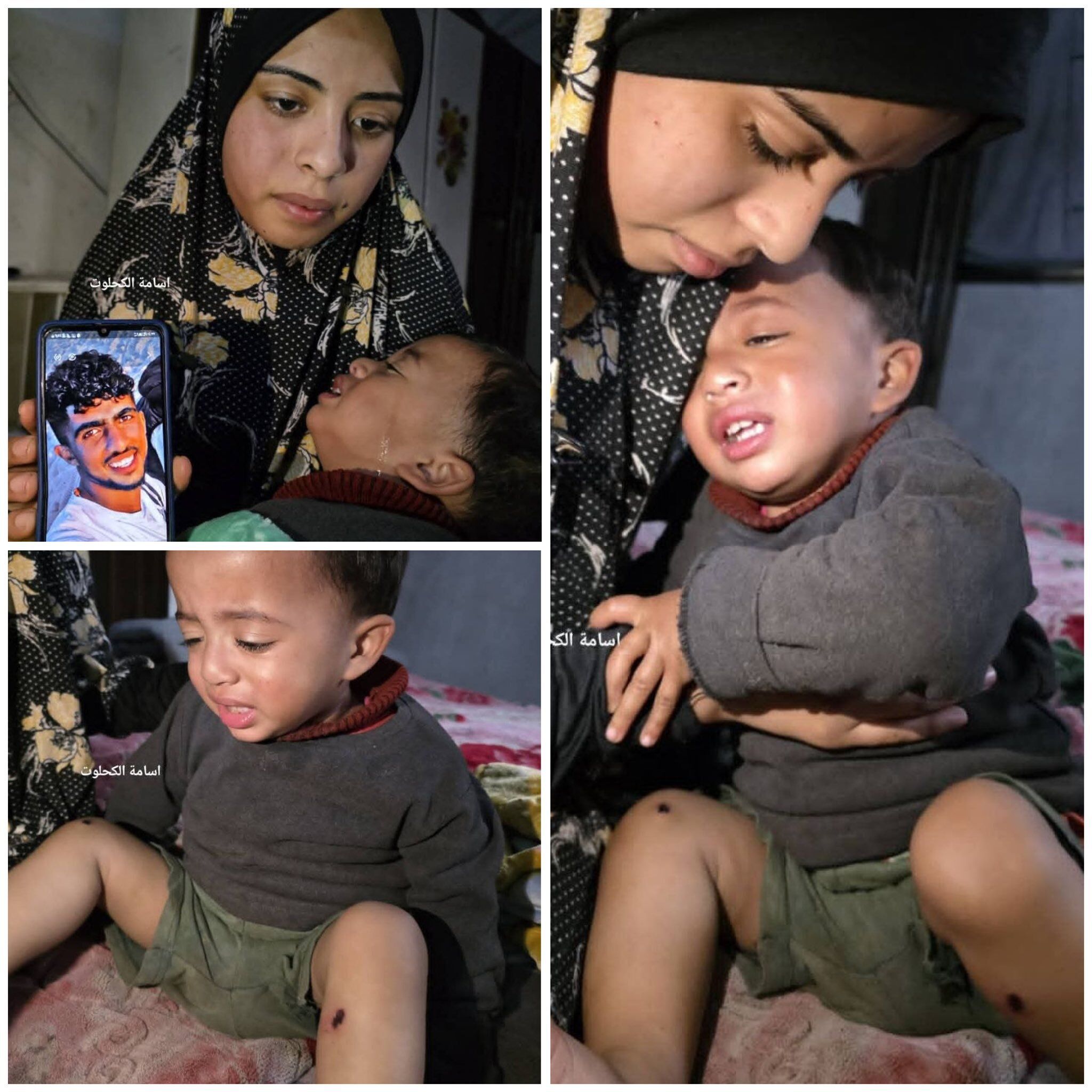 Siyonizm budur: israilliler 1 yaşındaki bebeğin bacaklarına çivi çaktı